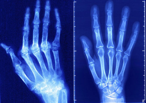 New Zealand Bee Venom Joint Bee Venom Pain And Bone Healing Cream (New Zealand Bee Extract – Specializes In Orthopedic Diseases And Arthritis Pain)