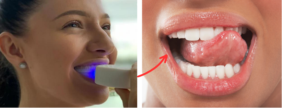 https://bucket-o39pcy.s3.ap-southeast-1.amazonaws.com/cdn_reup/202406/3d38e56bfd5771d4d97cced99b43580bc8c2bab4.png Lumibite