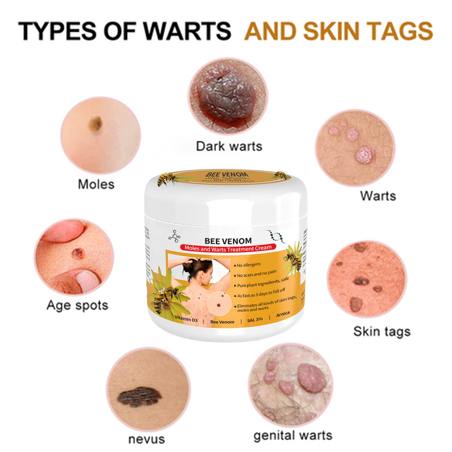 Bee Venom Mole And Wart Treatment Cream