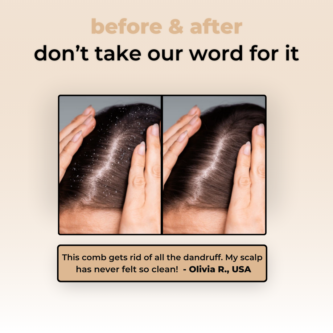 Evelyn – Scalp Comb