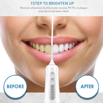 Hydroclean Portable Water Flosser