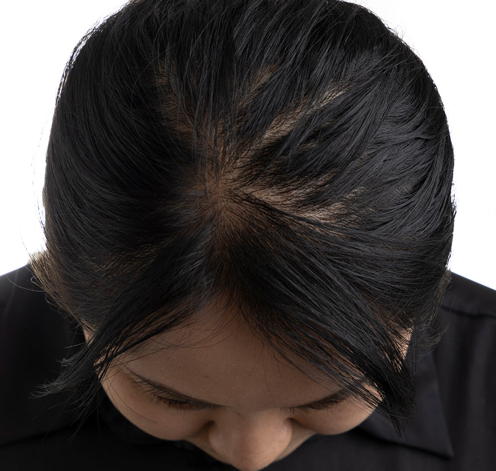 Revoscalp