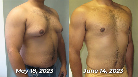 Mentherm Bee Venom Gynecomastia Heating Oil