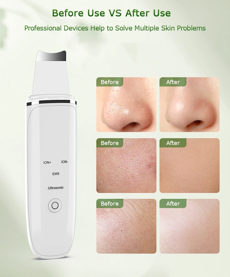 Ultrasonic Skin-pro™