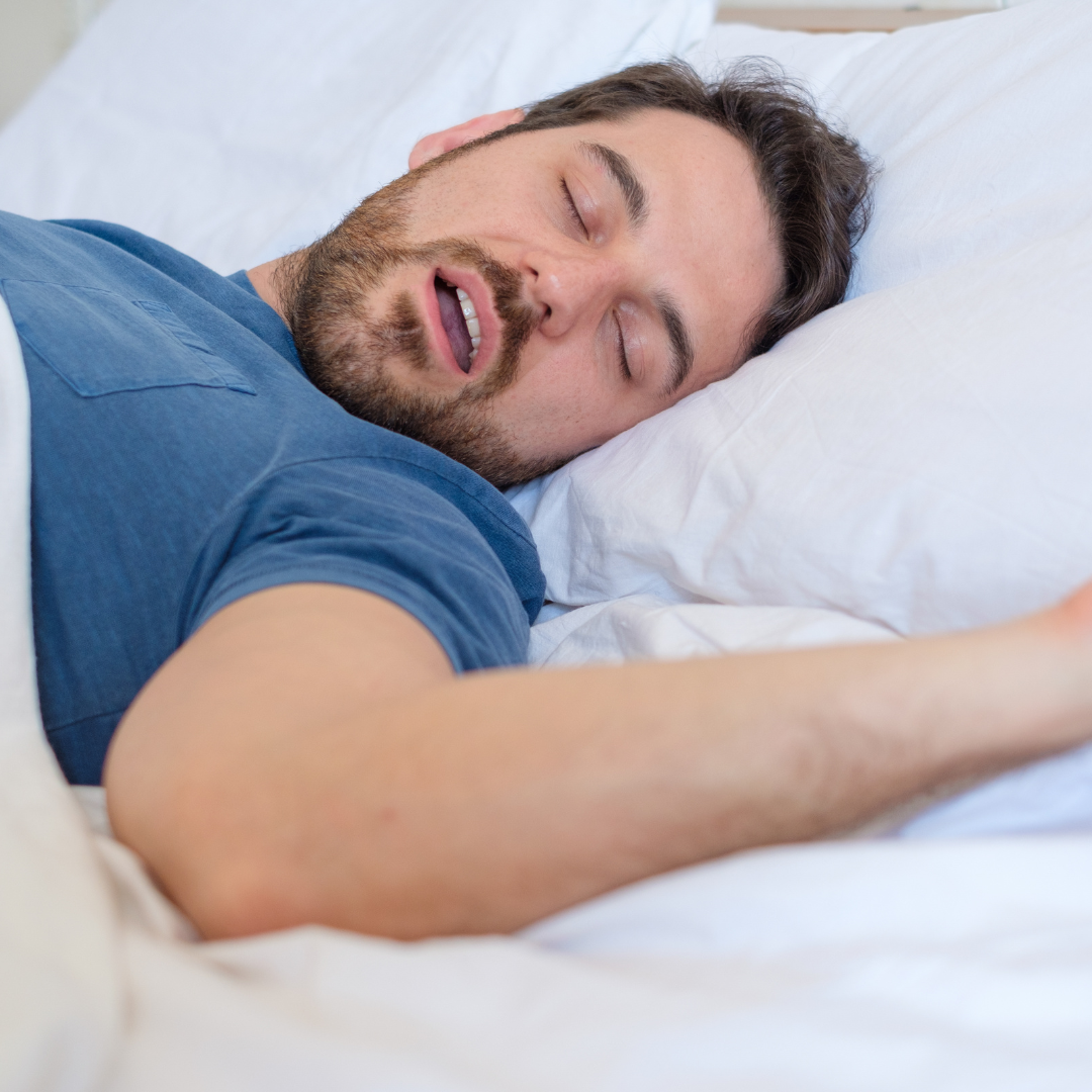 Snoreshield™ – Anti Snoring Device