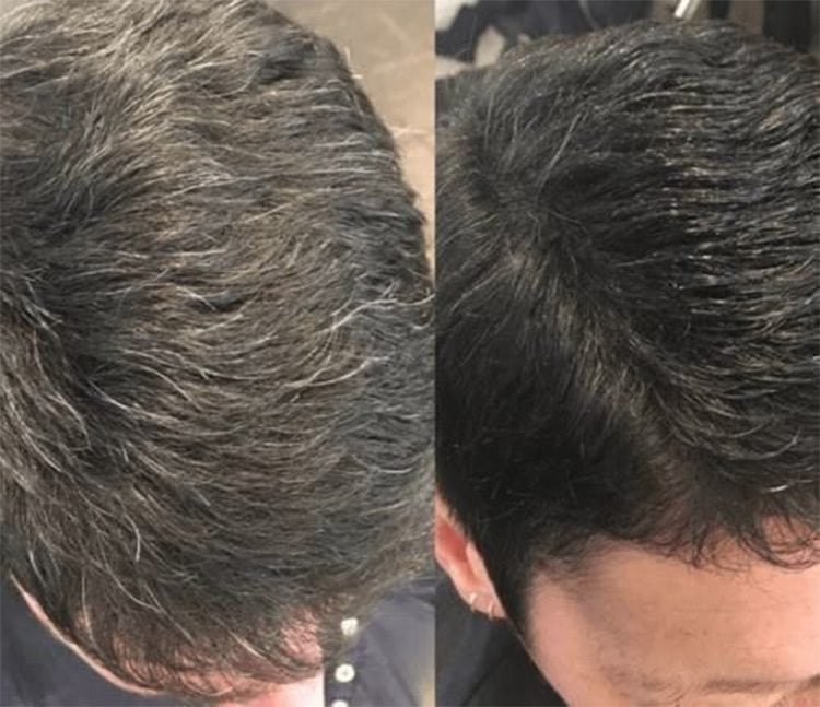 Limit Time 50% Off – Hair Instant Dye Shampoo