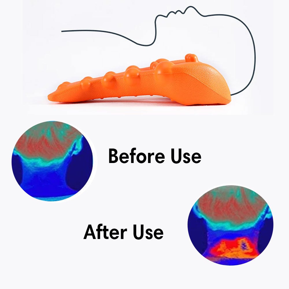 Therapoint Stretcher