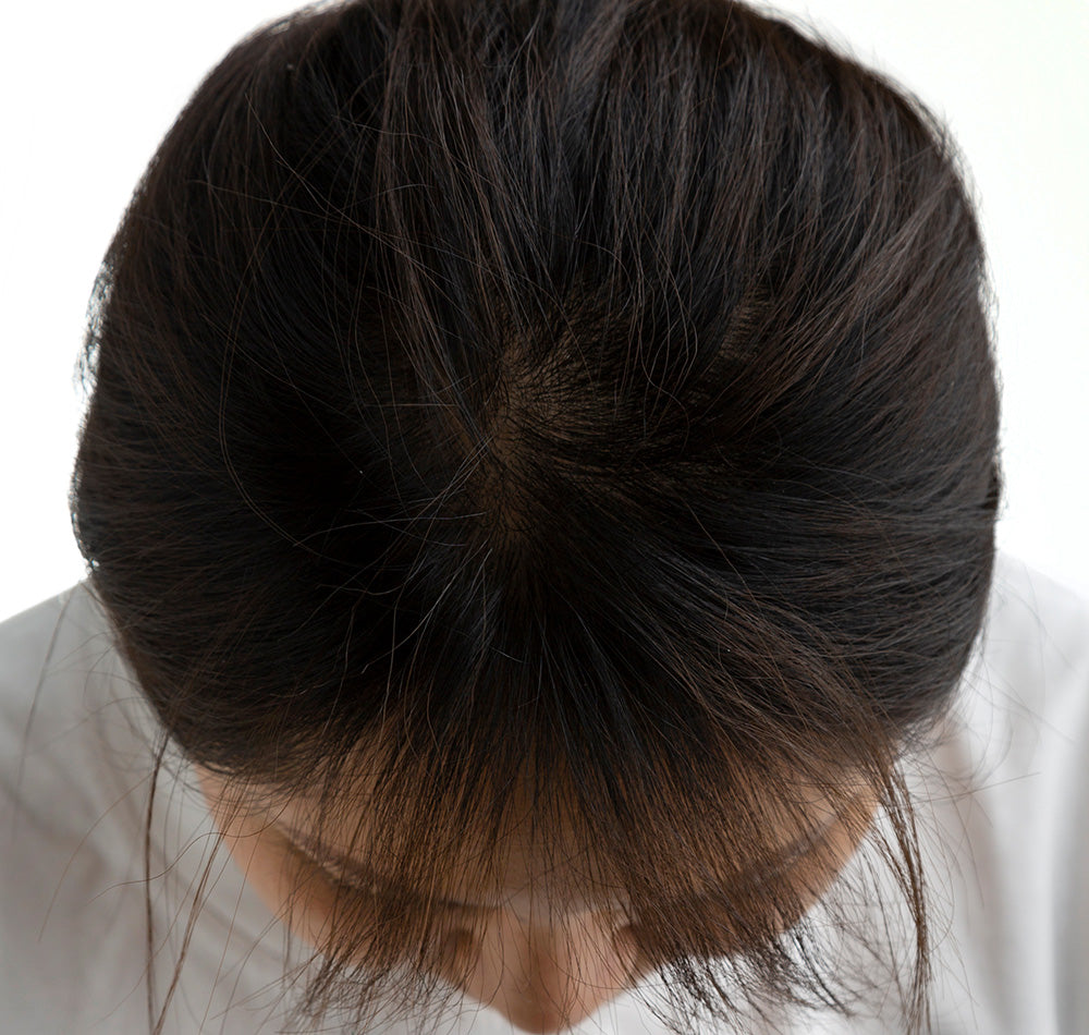 Revoscalp