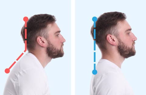 Recovist Neck Alignment Device - Instant Neck Pain Relief