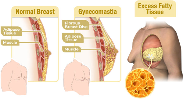 Mentherm Bee Venom Gynecomastia Heating Oil