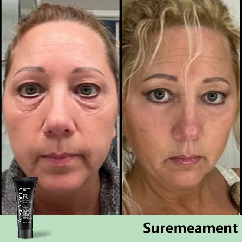 Last Day 49% Off – Instant Eye Temporary Eye Tightener