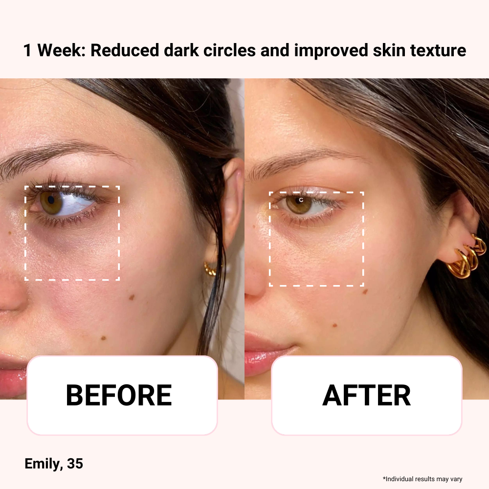 Luna&skin Booster Pro