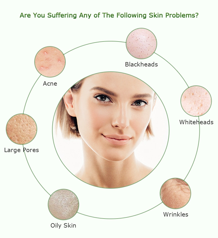 Ultrasonic Skin-pro™