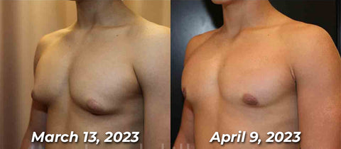 Mentherm Bee Venom Gynecomastia Heating Oil