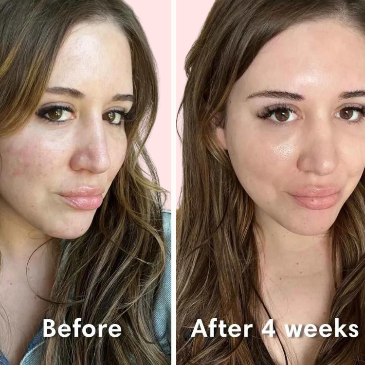 Cellera™ – Bio Collagen Mask