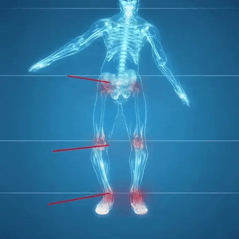 Ortoflex 5d - Orthopaedic Insole