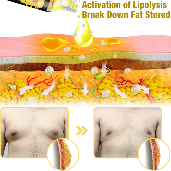 Mentherm Bee Venom Gynecomastia Heating Oil