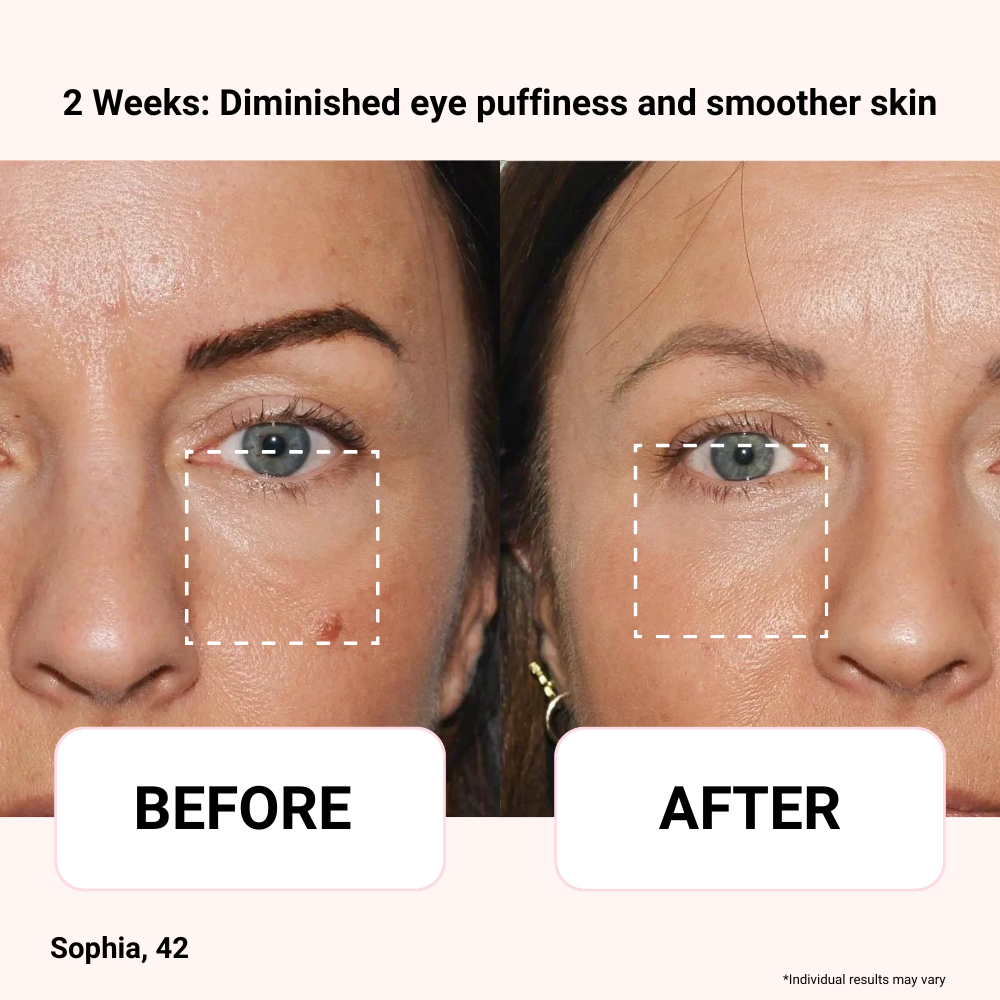 Luna&skin Booster Pro