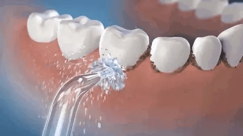 Hydroclean Portable Water Flosser