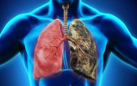 Breathe-right: Organic Herbal Lung Cleanse & Repair Respiratory Nasal Spray Pro