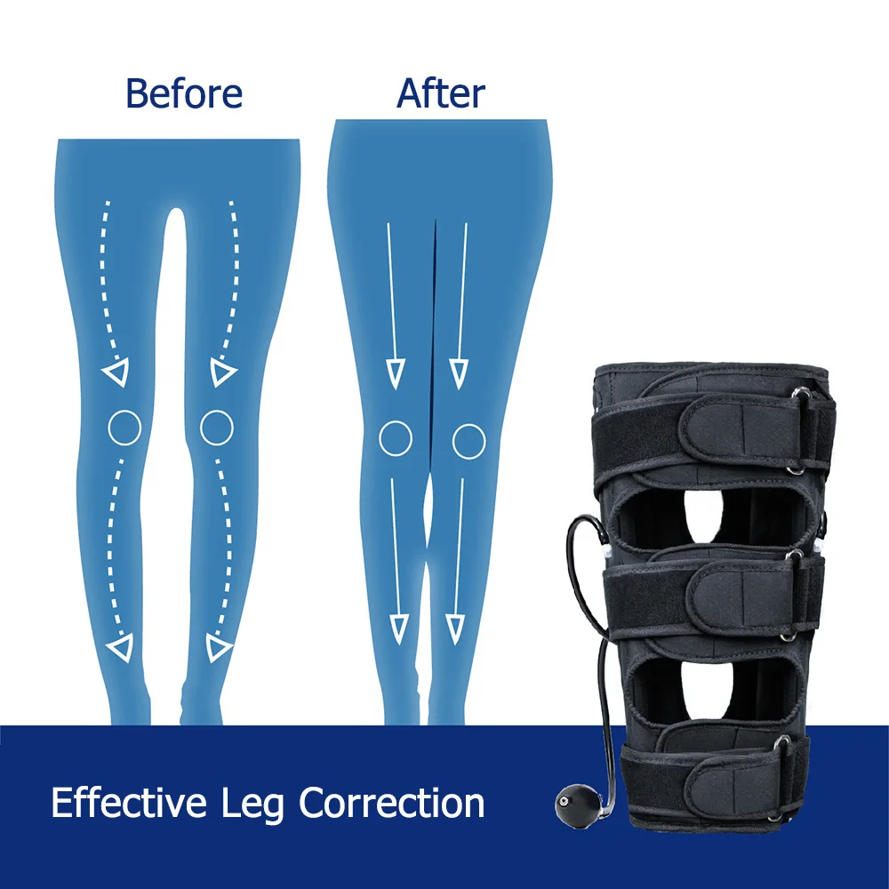 Bow Leg Correction Air Pressure Belt For Adults And Kids