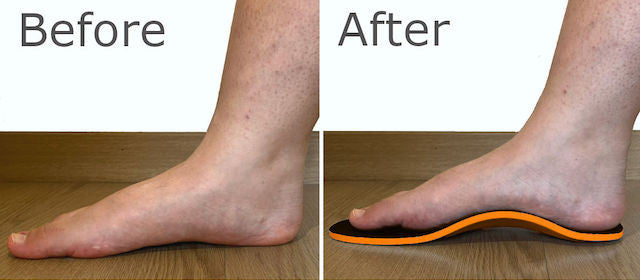 High Arch Support Insoles