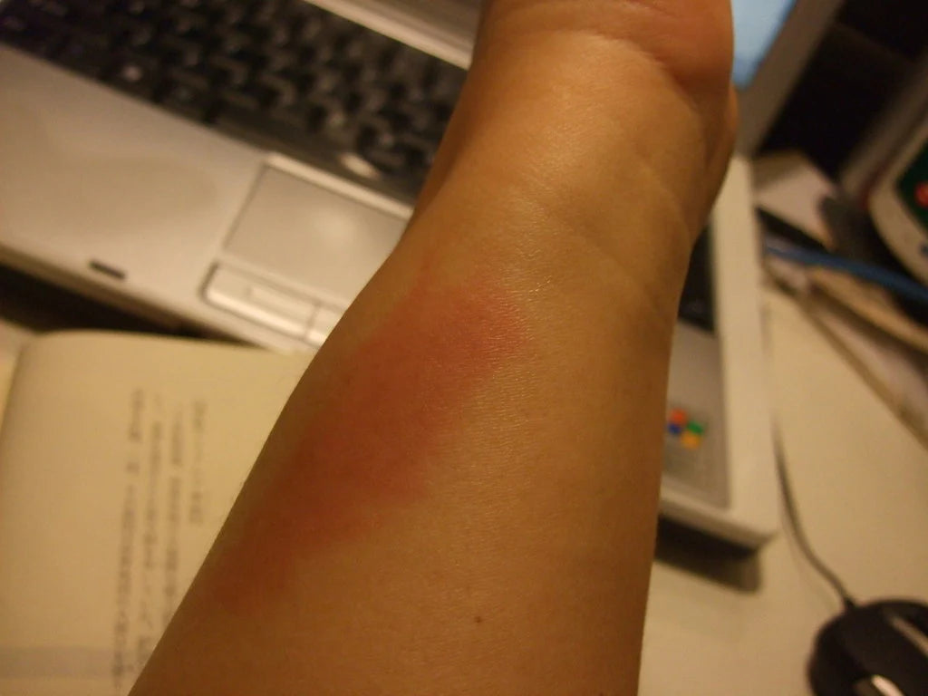 Dr.chilly™ - Ice Ring