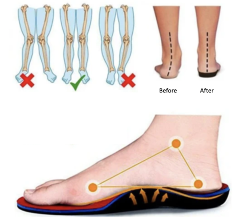 Last Day 49% Off – Women Slip-on Light Air Cushion Orthopedic Sneakers