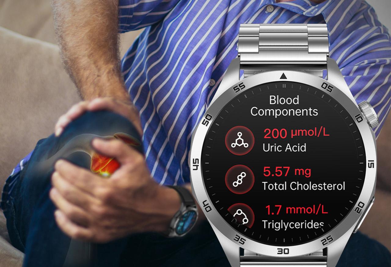 Intelligent Micro-physical Examination Blood Glucose Ecg Pressure Blood Oxygen Smartwatch