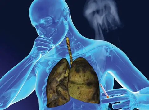 Breathe-right: Organic Herbal Lung Cleanse & Repair Respiratory Nasal Spray Pro
