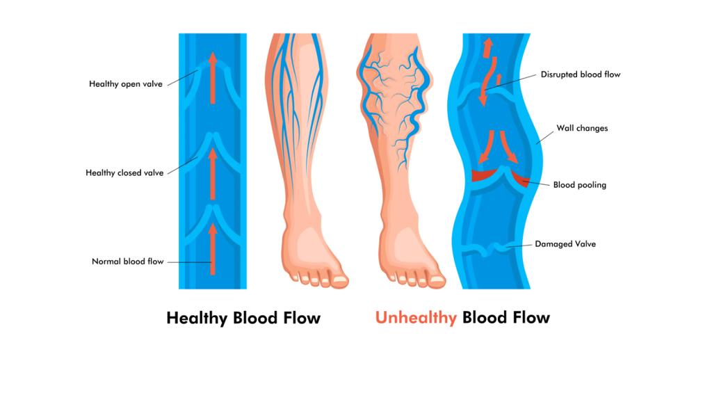 Soothing Back – Compression Socks Australia