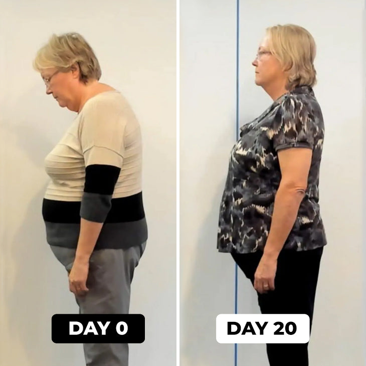 Adjustable Posture Corrector Belt