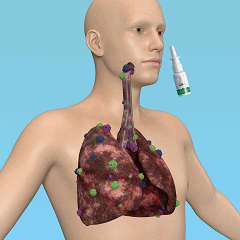 Breathe-right: Organic Herbal Lung Cleanse & Repair Respiratory Nasal Spray Pro