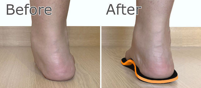 High Arch Support Insoles