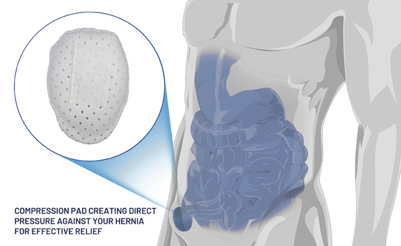 Adjustable Inguinal Hernia Belt For Men Left Or Right Side