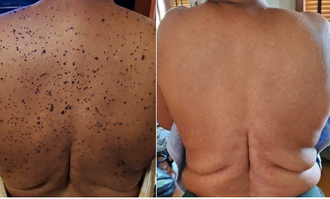 Bee Venom Treatment Cream