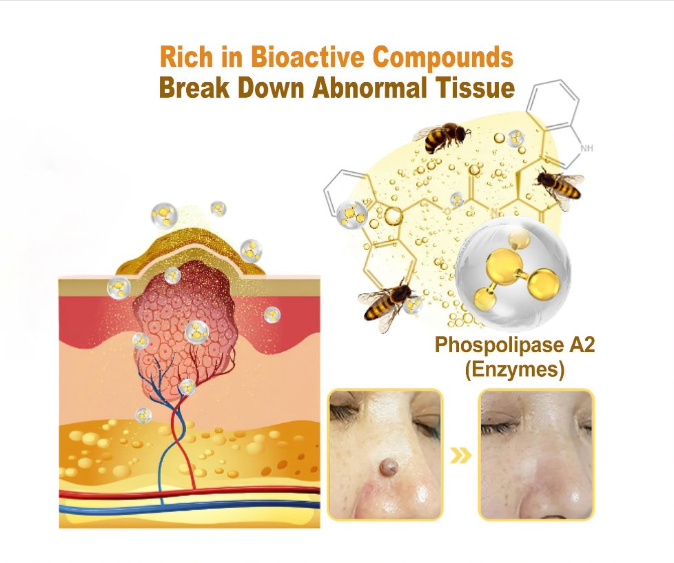 Bee Venom Treatment Cream