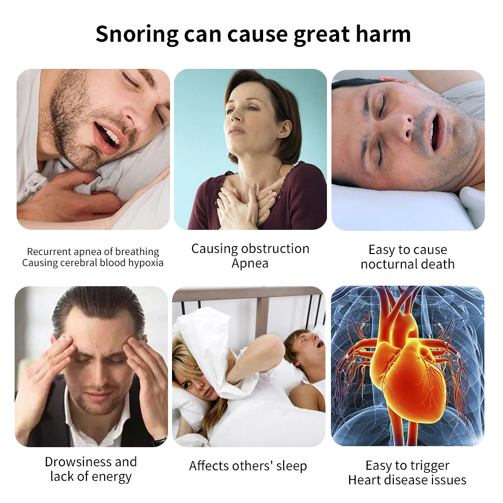 Z3 Pro – Professional Anti-snoring Device