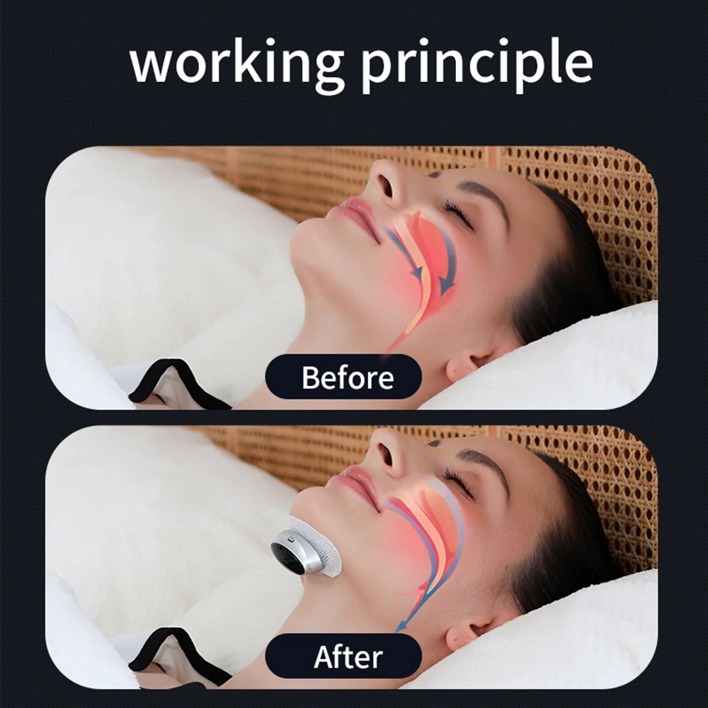 Z3 Pro – Professional Anti-snoring Device