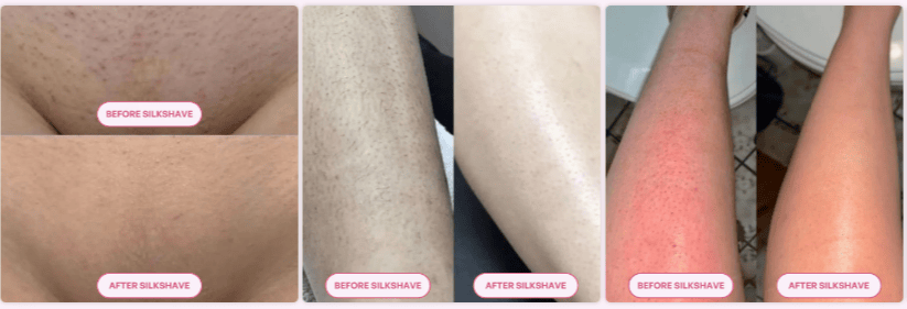 Glowira™ 2-in-1 Electric Shaver