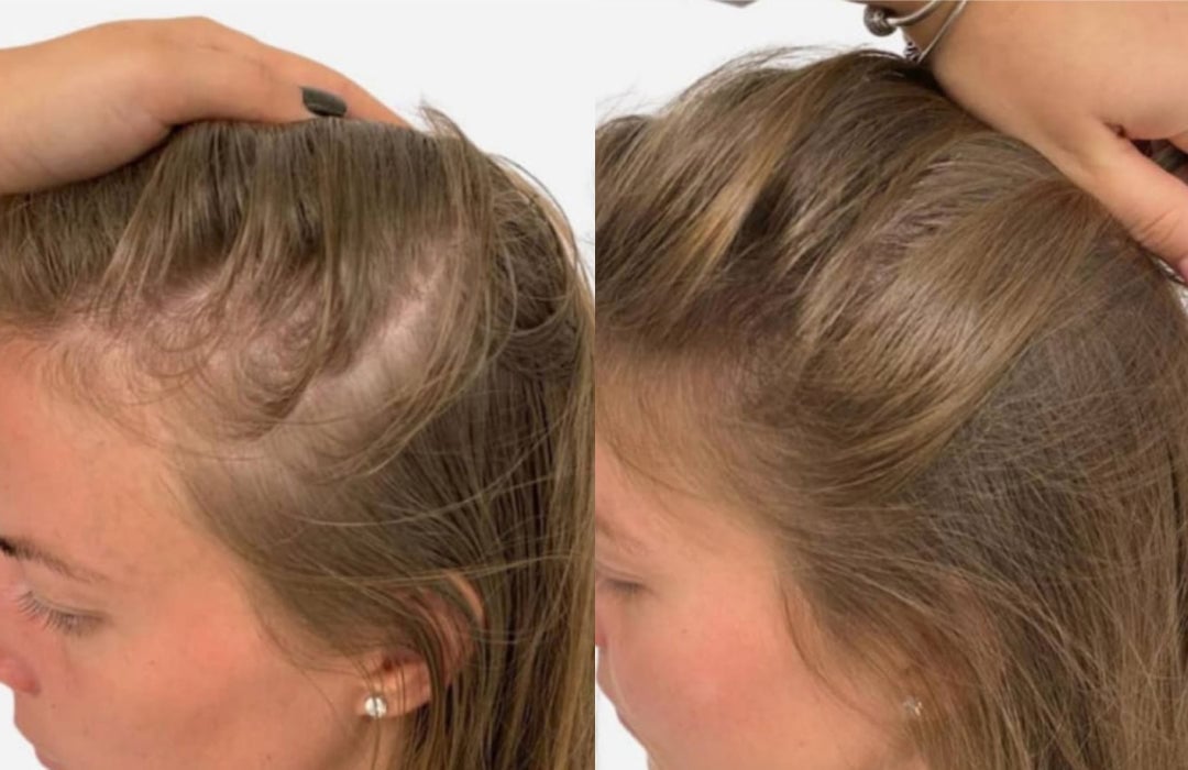 3-in-1 Hair Regrowth Comb