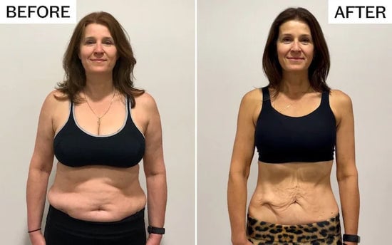 Pilates Reformer Pro