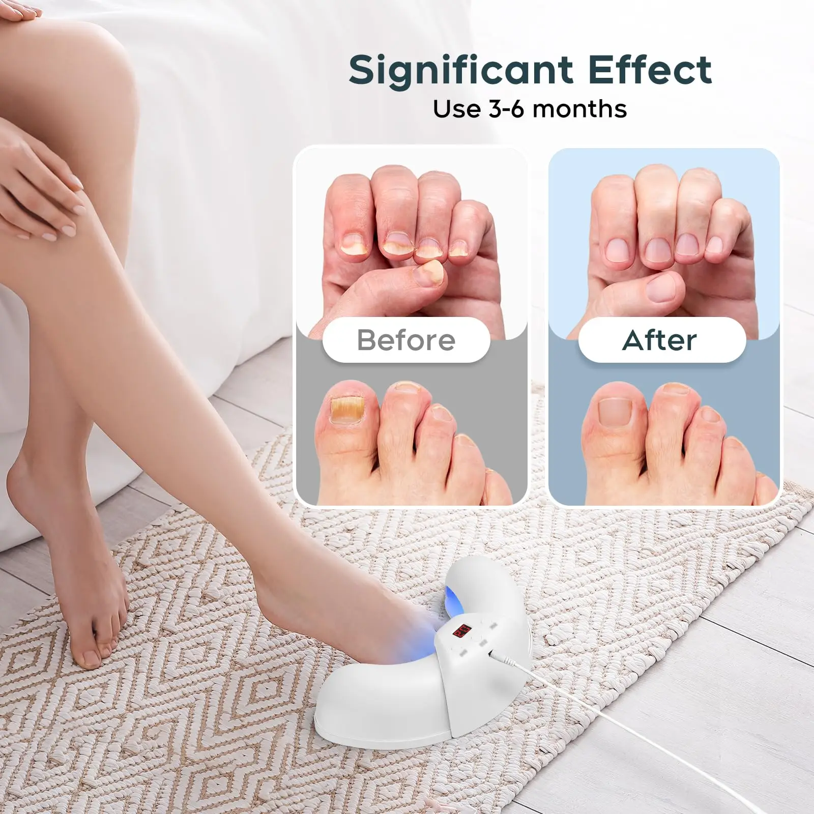 Say Goodbye To Nail Fungus – Fast & Visible Results!