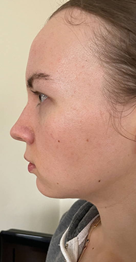 Omni™ - Led Microcurrent Handset (3 In 1)