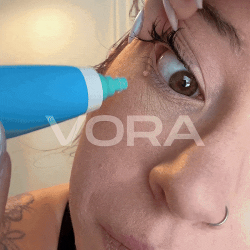 Tagbuddy Kit™ - No More Skin Tags
