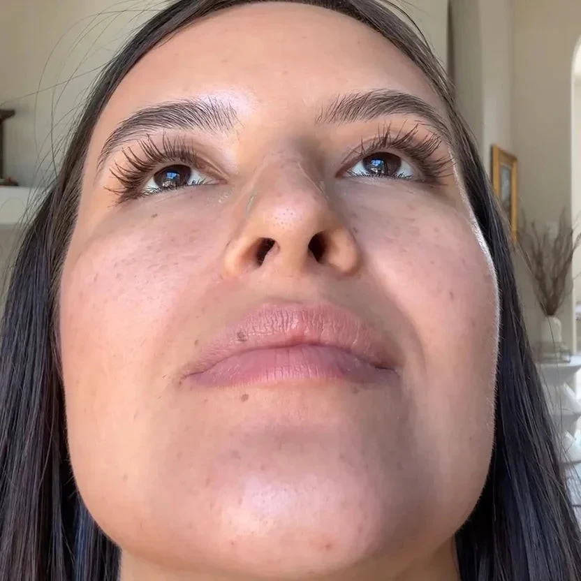 Aerium Nasal Dilator Kit