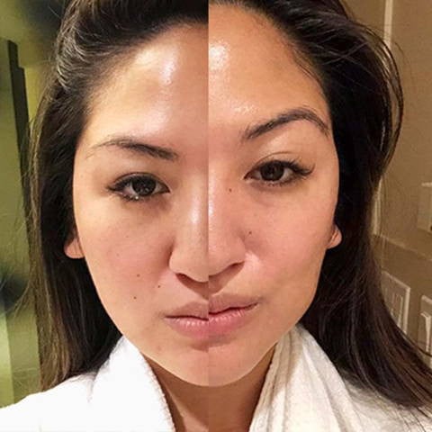 Omni™ - Led Microcurrent Handset (3 In 1)