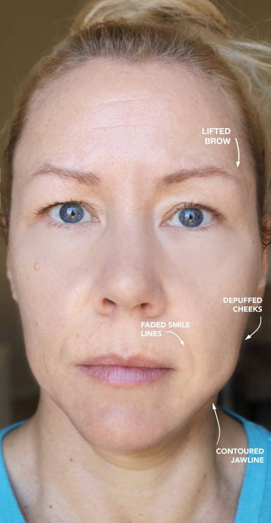 Omni™ - Led Microcurrent Handset (3 In 1)