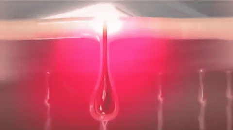 Ylvis Ipl Hair Remover