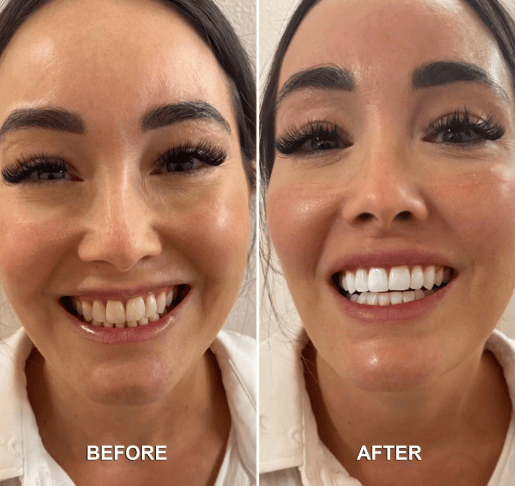 Teeth Whitening Powder